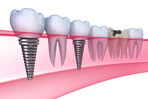Reflexology and Dental Care